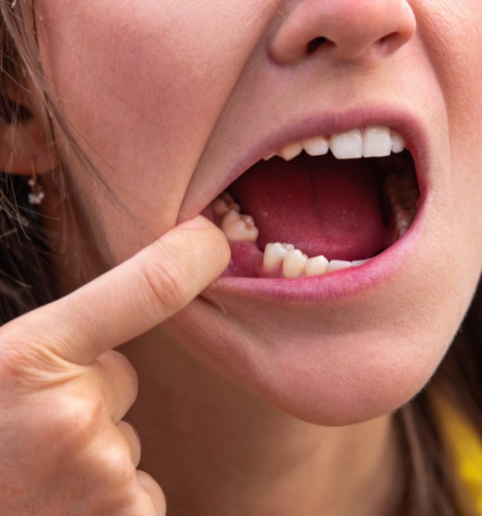 Restorative Dentistry — Century City dental care